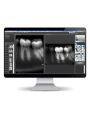 Intraoral Dental X Ray Sensor Ateco Brand Made in UK